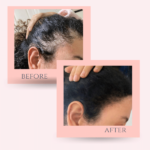 Huile de Pousse Cheveux naturelle – Image 2